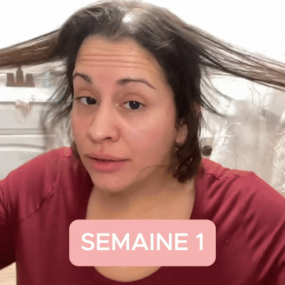 Spray Anti-Chute Capillaire || Recommandé par les dermatologues